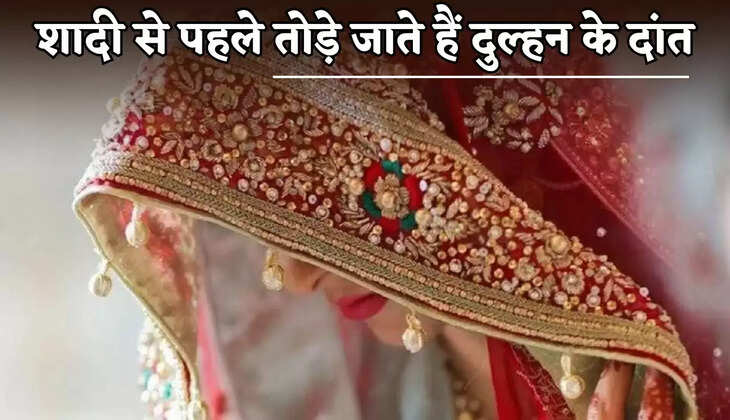 The bride's teeth are broken before the wedding.