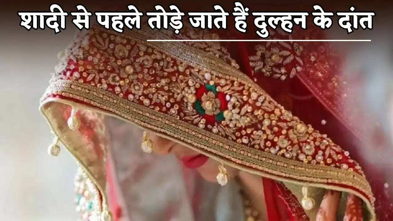 The bride's teeth are broken before the wedding.